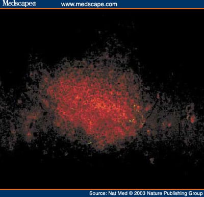 Autoimmune Islet Destruction in Spontaneous Type 1 Diabetes - Page 2