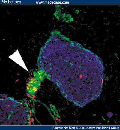 Autoimmune Islet Destruction in Spontaneous Type 1 Diabetes - Page 5