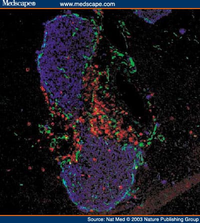 Autoimmune Islet Destruction in Spontaneous Type 1 Diabetes - Page 5