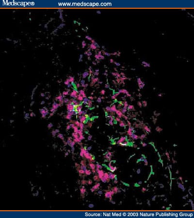 Autoimmune Islet Destruction in Spontaneous Type 1 Diabetes - Page 5