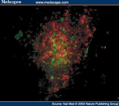 Autoimmune Islet Destruction in Spontaneous Type 1 Diabetes - Page 5