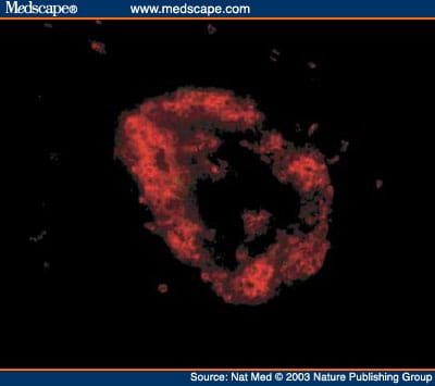 Autoimmune Islet Destruction in Spontaneous Type 1 Diabetes - Page 5
