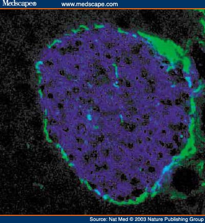 Autoimmune Islet Destruction in Spontaneous Type 1 Diabetes - Page 6