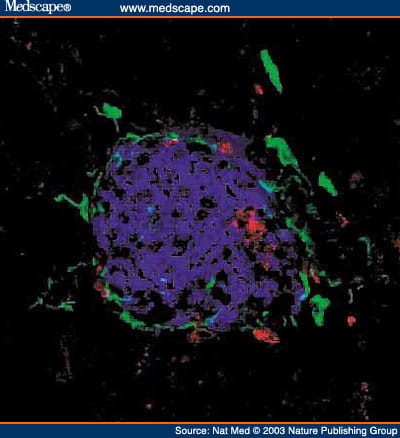 Autoimmune Islet Destruction in Spontaneous Type 1 Diabetes - Page 6