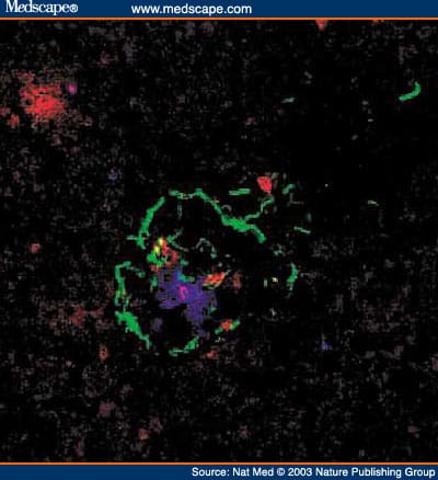Autoimmune Islet Destruction in Spontaneous Type 1 Diabetes - Page 6