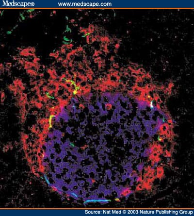 Autoimmune Islet Destruction in Spontaneous Type 1 Diabetes - Page 6