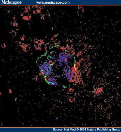 Autoimmune Islet Destruction in Spontaneous Type 1 Diabetes - Page 6