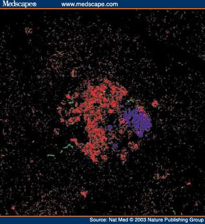 Autoimmune Islet Destruction in Spontaneous Type 1 Diabetes - Page 6