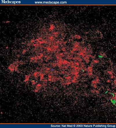 Autoimmune Islet Destruction in Spontaneous Type 1 Diabetes - Page 6