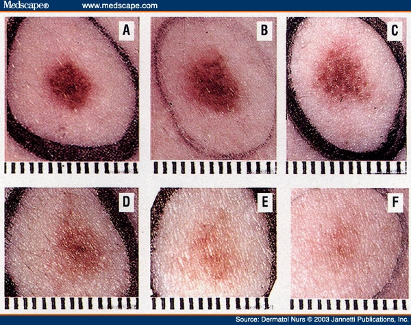 dn458328.fig19.jpg