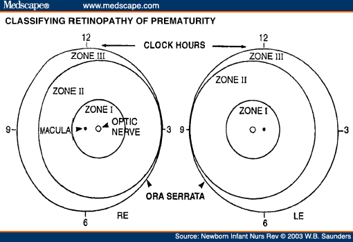 Standards Rop Frame A Review of Retinopathy of Prematurity and Long-Term Outcomes - Page 4