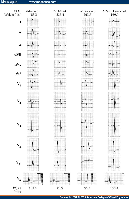 A Comparison of 2-Lead, 6-Lead, and 12-Lead ECGs in Patients - Page 2