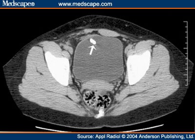 Radiological Case of the Month