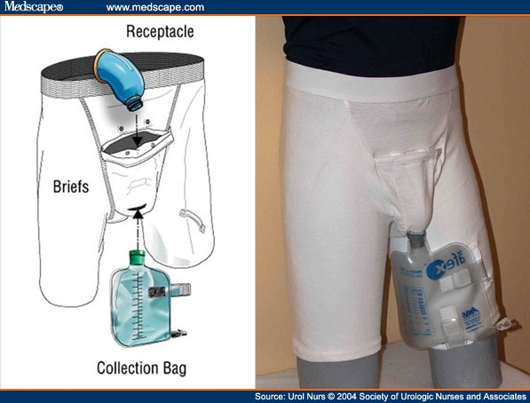 Incontinence Products and Devices for the Elderly
