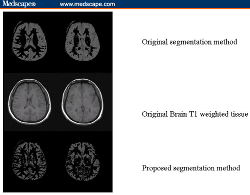 Brain White and Gray Matter Anatomy of MRI Segmentation - Page 3