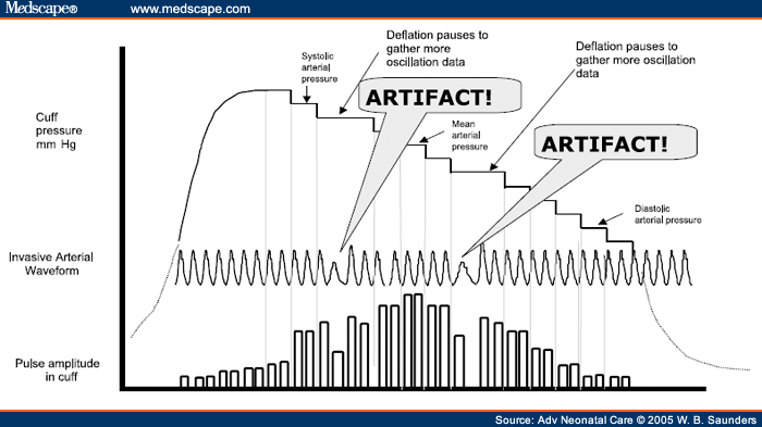 https://img.medscapestatic.com/fullsize/migrated/514/540/adnc514540.fig3.gif