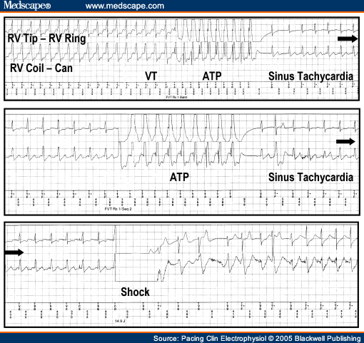 Advanced ICD Troubleshooting: Part I - Page 3