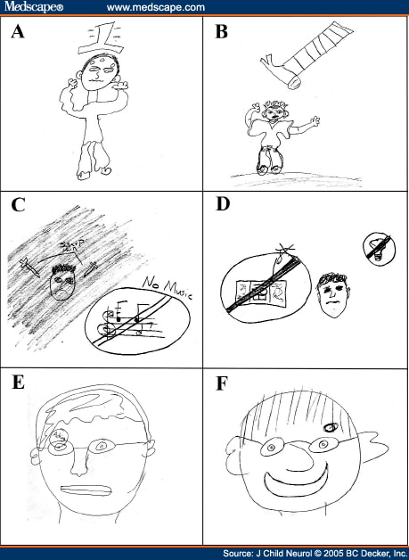 Serial Headache Drawings by Children With Migraine - Page 3