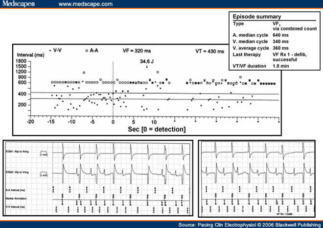 Advanced ICD Troubleshooting: Part II - Page 3