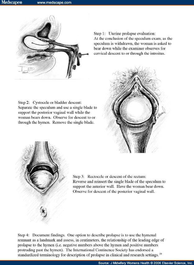 Common Problems Of Urination In Nonpregnant Women 4485