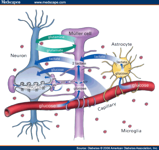 Diabetic Retinopathy: Seeing Beyond Glucose-Induced Microvascular ...