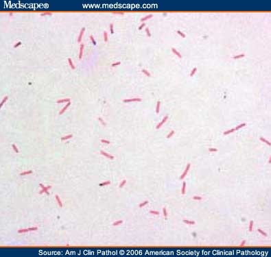 Errors in Interpretation of Gram Stains From Positive Blood Cultures