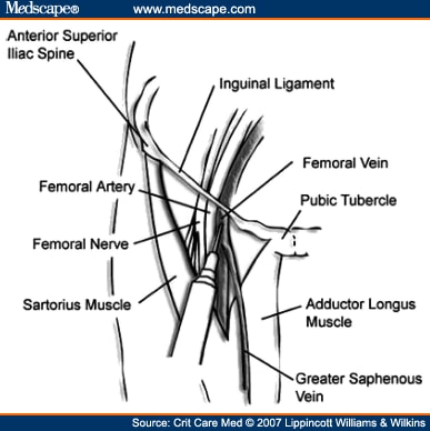 Central Venous Catheterization: Concise Definitive Review