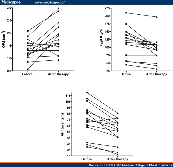 Diuretics in Obstructive Sleep Apnea With Diastolic Heart Failure - Page 3