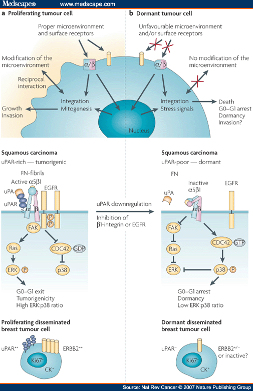 Models, Mechanisms And Clinical Evidence For Cancer Dormancy