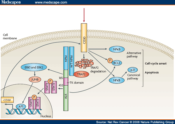 The Anaplastic Lymphoma Kinase in the Pathogenesis of Cancer