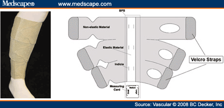 Inelastic versus Elastic Compression Stocking - Page 2