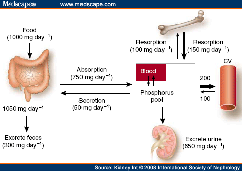 Hyperphosphatemia of Chronic Kidney Disease