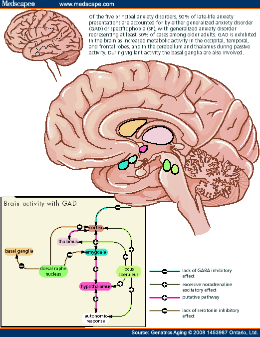anxiety disorder brain