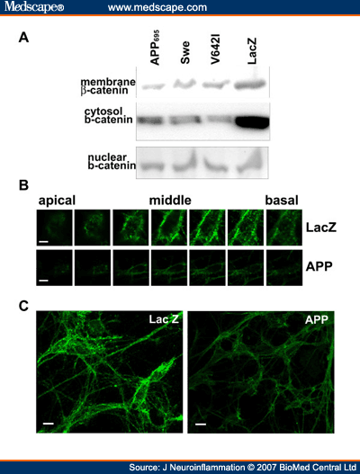 Amyloid Precursor Protein Modulates Beta-Catenin Degradation - Page 3