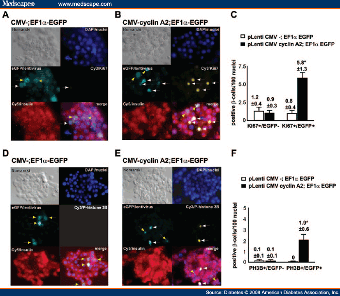 Gallery Detail: Exendin 4 Stimulation Of Cyclin A2 In B Cell Proliferation