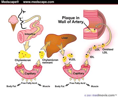 do statins reduce plaque build up