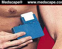 Hyperhidrosis: Current Understanding, Current Therapy