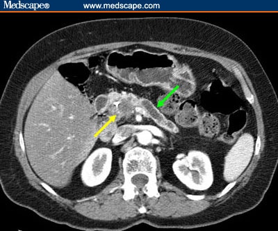 Computed Tomography of the Abdomen and Pelvis: A Guide for Referring ...