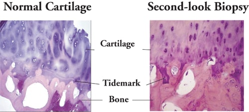 Management of Osteoarthritis Knee Pain: The State of the Science