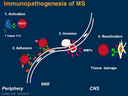 Investigating Multiple Sclerosis: Targeting Therapeutic Options