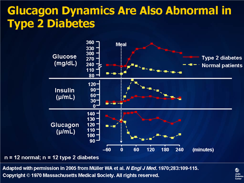 Type 2 Diabetes: Understanding the Etiology