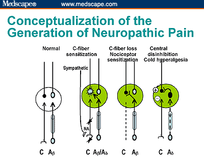 Towards an Understanding of Pain in Diabetic Neuropathy