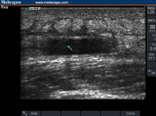 ultrasound training program ultrasound training program