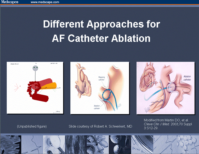 Atrial Fibrillation: What's New in Nonpharmacologic Therapy