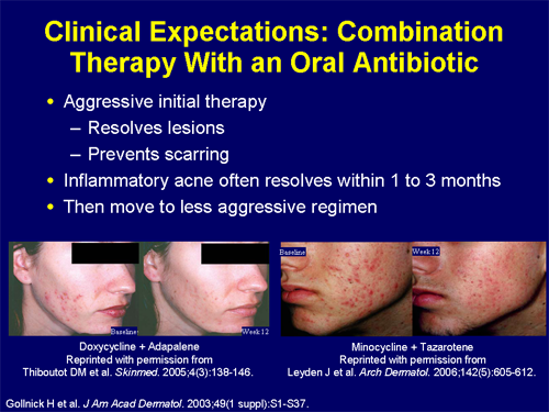 Advancements in Oral Antibiotic Therapy for the Treatment of Moderate