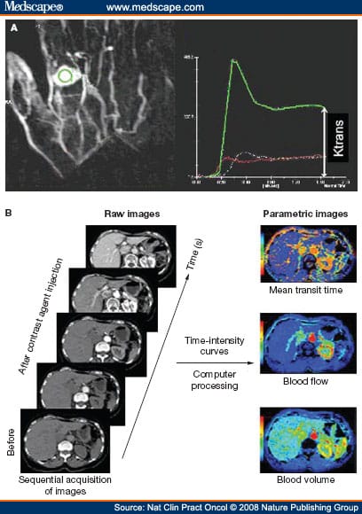 Biomarkers of Angiogenesis for the Development of Antiangiogenic Therapies