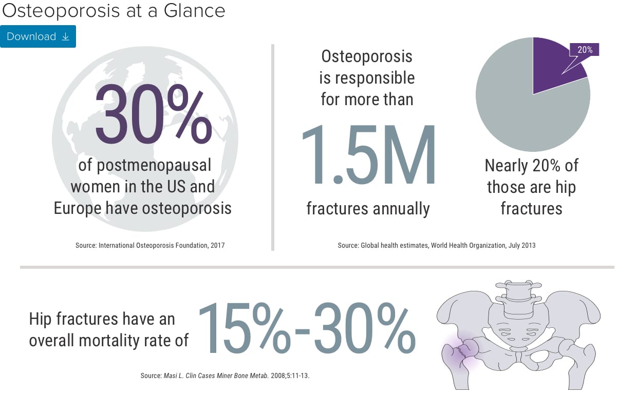 Osteoporosis Protecting Bones, Preventing Breaks