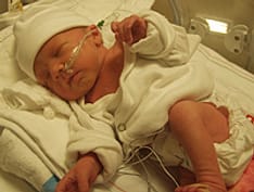 PRAC Wants Numeta G13%E Off the Market