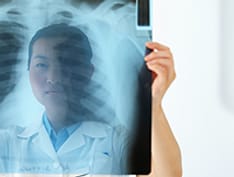 Lung Cancer Screening in the Elderly