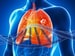 Hot Breath Could Signal Lung Cancer
